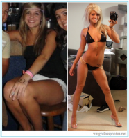 /album/fenykepgaleria/a74-weight-loss-before-after-women-bikini-large-png/