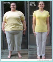 /album/fenykepgaleria/a304-extreme-weight-loss-before-after-women-png/